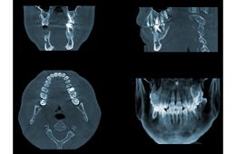 あざみ野フォレスト歯科の検査画像