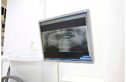 CTのイメージ画像